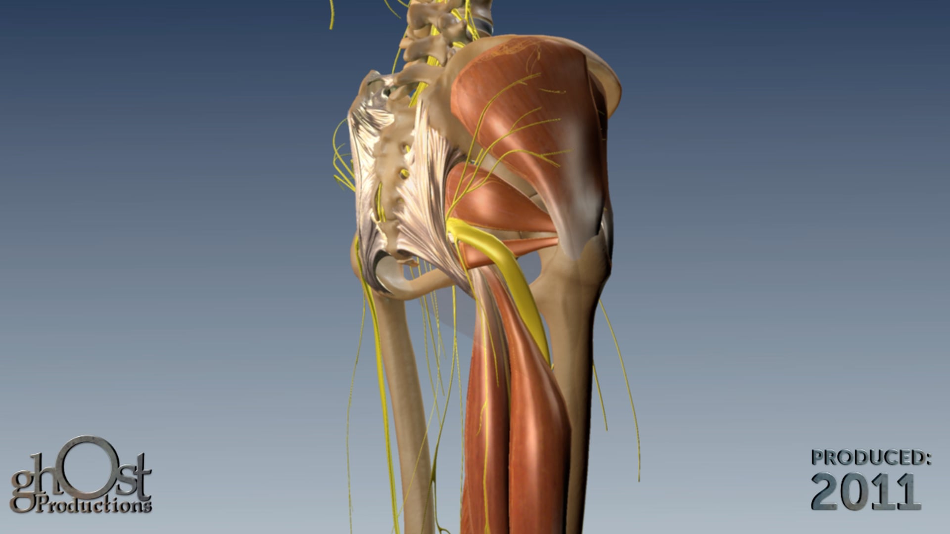 SI-Bone Anatomic
